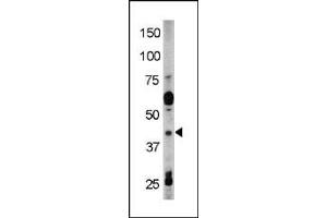 The anti-Phospho-Rad9-Y28 Pab (ABIN389639 and ABIN2839631) is used in Western blot to detect Phospho-Rad9-Y28 in HL60 tissue lysate (RAD9A Antikörper  (pTyr28))