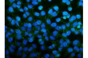 IF analysis of PAR-3/PARD3 using anti-PAR-3/PARD3 antibody (ABIN7598983). (PARD3 Antikörper  (AA 1-1346))