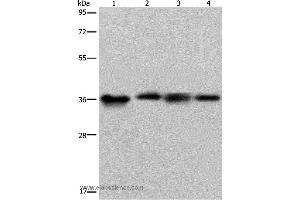Western blot analysis of HepG2 and 293T cell, human kidney cancer tissue and K562 cell, using F11R Polyclonal Antibody at dilution of 1:500 (F11R Antikörper)
