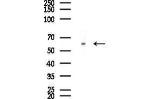 anti-Chloride Channel CLIC-Like 1 (CLCC1) (Internal Region) antibody