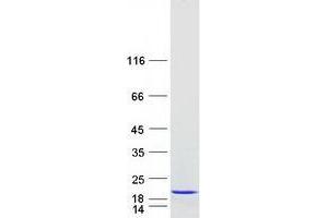 Western Blotting (WB) image for Ubiquitin-Conjugating Enzyme E2A (ube2a) (Transcript Variant 1) protein (Myc-DYKDDDDK Tag) (ABIN2734779)