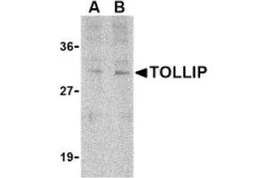 Image no. 1 for anti-Toll Interacting Protein (TOLLIP) (C-Term) antibody (ABIN265153)