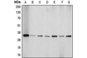 Western blot analysis of Aquaporin 4 expression in HeLa (A), Jurkat (B), PC12 (C), SP2/0 (D), HepG2 (E), U87MG (F), mouse brain (G) whole cell lysates. (Aquaporin 4 Antikörper  (Center))