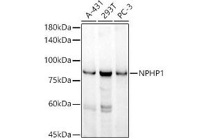 Western blot analysis of extracts of various cell lines, using NPHP1 antibody (ABIN7268847) at 1:1000 dilution. (NPHP1 Antikörper)