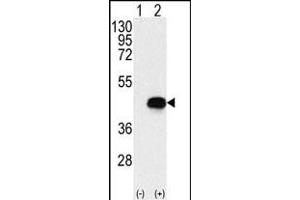 Western blot analysis of BCKDK (arrow) using rabbit polyclonal BCKDK Antibody (Center) (ABIN391176 and ABIN2841276). (BCKDK Antikörper  (AA 120-151))