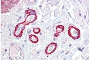 Anti-SLC39A14 antibody IHC staining of human colon, vessels. (SLC39A14 Antikörper  (Internal Region))