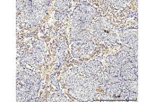 IHC analysis of MT-ND5 using anti-MT-ND5 antibody (ABIN7600145). (MT-ND5 Antikörper  (AA 154-570))