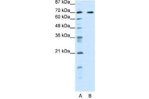 WB Suggested Anti-FOXK2  Antibody Titration: 0. (Forkhead Box K2 Antikörper  (Middle Region))