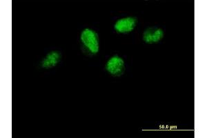 Immunofluorescence of purified MaxPab antibody to TCEB3 on HeLa cell.
