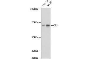 Western blot analysis of extracts of various cell lines, using CBS Rabbit mAb (ABIN7266615) at 1:1000 dilution. (CBS Antikörper)