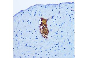 Immunohistochemistry of paraffin-embedded mouse heart using GRP Rabbit pAb (ABIN6127573, ABIN6141433, ABIN6141434 and ABIN6222002) at dilution of 1:100 (40x lens). (Gastrin-Releasing Peptide Antikörper  (AA 1-148))