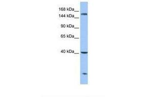 Image no. 1 for anti-Carboxypeptidase D (CPD) (AA 181-230) antibody (ABIN6738857) (CPD Antikörper  (AA 181-230))