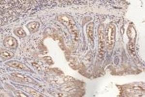 Immunohistochemistry analysis of paraffin-embedded rat colon using,PFDN4 (ABIN7075171) at dilution of 1: 4200 (PFDN4 Antikörper)