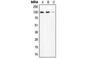 Western blot analysis of PLC beta 2 expression in HeLa (A), SP2/0 (B), H9C2 (C) whole cell lysates.