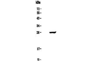 Western blot analysis of Serum Amyloid P using anti-Serum Amyloid P antibody . (APCS Antikörper  (AA 20-220))