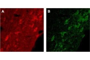 Expression of p75NTR in rat brainImmunohistochemical staining of rat brain with Anti-p75 NGF Receptor (extracellular) Antibody (ABIN7043344, ABIN7044755 and ABIN7044756). (Nerve Growth Factor Receptor (NGFR) Peptid)