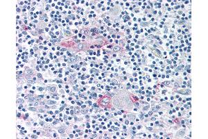 Anti-ROR Gamma antibody IHC of human thymus. (RORC Antikörper  (Ligand Binding Domain))