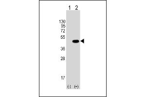 Western blot analysis of Tag-HA. (HA-Tag Antikörper)