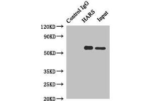 Immunoprecipitating HARS in Hela whole cell lysate Lane 1: Rabbit control IgG instead of (1 μg) instead of ABIN7155257 in Hela whole cell lysate. (HARS1/Jo-1 Antikörper  (AA 1-180))