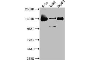 Western Blot Positive WB detected in: Hela whole cell lysate, K562 whole cell lysate, HepG2 whole cell lysate All lanes: Bub1 antibody at 1:1000 Secondary Goat polyclonal to rabbit IgG at 1/50000 dilution Predicted band size: 123, 116, 120 kDa Observed band size: 130 kDa (Rekombinanter BUB1 Antikörper)