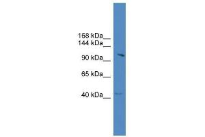 KIAA1604 antibody used at 0. (CWC22 Antikörper  (C-Term))