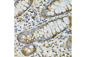 Immunohistochemistry of paraffin-embedded human colon using GSTM2 Antibody (ABIN6292965) at dilution of 1:100 (40x lens).