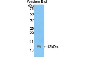 Detection of Recombinant ARPC4, Mouse using Polyclonal Antibody to Actin Related Protein 2/3 Complex Subunit 4 (ARPC4) (ARPC4 Antikörper  (AA 79-164))