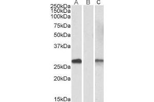 Lane A - ABIN571107 (1µg/ml) staining of HEK293 overexpressing Human DYDC1 lysate (10µg protein in RIPA buffer) Lane B - ABIN571107 (0. (DYDC1 Antikörper  (AA 142-154))