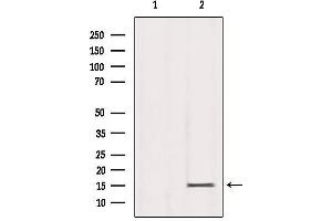 Western blot analysis of extracts from Mouse Spleen, using Histone H3K79me3 Antibody. (Histone 3 Antikörper  (H3K79me3))