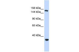 EIF4G3 antibody used at 1 ug/ml to detect target protein. (EIF4G3 Antikörper  (Middle Region))