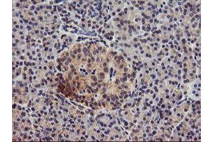 Immunohistochemical staining of paraffin-embedded Human pancreas tissue using anti-DGKA mouse monoclonal antibody. (DGKA Antikörper)