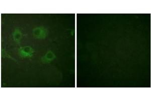 Immunofluorescence analysis of HuvEc cells, using Claudin 3 antibody (ABIN5976357). (Claudin 3 Antikörper  (C-Term))