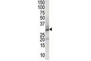 DSCR1 antibody used in western blot to detect DSCR1 in endothelial cell lysate (RCAN1 Antikörper  (AA 75-104))