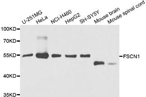 Western blot analysis of extracts of various cell lines, using FSCN1 antibody. (Fascin Antikörper)