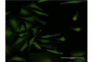 Immunofluorescence of monoclonal antibody to CSNK2A2 on HeLa cell. (CSNK2A2 Antikörper  (AA 1-100))