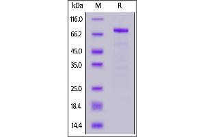 Human IL-11 R alpha, Fc Tag on  under reducing (R) condition. (IL11RA Protein (AA 24-370) (Fc Tag))