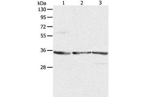 Western Blot analysis of NIH/3T3, A431 and Jurkat cell using RPLP0 Polyclonal Antibody at dilution of 1:750 (RPLP0 Antikörper)