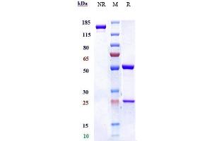 Anti-IL-5 Reference Antibody (mepolizumab) on SDS-PAGE under reducing (R) condition.