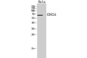 Western Blotting (WB) image for anti-Glycoprotein V (Platelet) (GP5) (Internal Region) antibody (ABIN3178933) (GP5 Antikörper  (Internal Region))