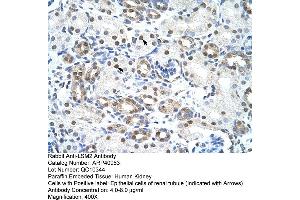 Rabbit Anti-LSM2 Antibody  Paraffin Embedded Tissue: Human Kidney Cellular Data: Epithelial cells of renal tubule Antibody Concentration: 4. (LSM2 Antikörper  (Middle Region))