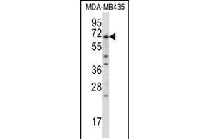 Western blot analysis in MDA-MB435 cell line lysates (35ug/lane). (BIRC3 Antikörper  (N-Term))