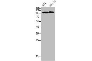 Western Blot analysis of 3T3 HEPG2 cells using Collagen alpha-1(XXVIII)Polyclonal Antibody diluted at 1:1000. (COL28A1 Antikörper  (AA 111-160))