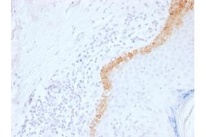 Formalin-fixed, paraffin-embedded human Skin stained with Cytokeratin 15 Mouse Monoclonal Antibody (LHK15). (KRT15 Antikörper  (C-Term))