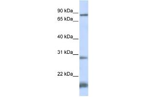 WB Suggested Anti-SMYD4 Antibody Titration:  0. (SMYD4 Antikörper  (N-Term))