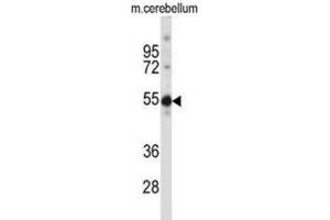 Western Blotting (WB) image for anti-TSPY-Like 5 (TSPYL5) antibody (ABIN2997414)
