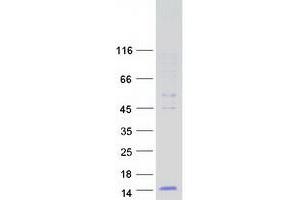 Western Blotting (WB) image for Defensin, beta 124 (DEFB124) protein (Myc-DYKDDDDK Tag) (ABIN2719366)