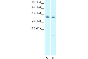 WB Suggested Anti-PTGER3 Antibody Titration:  2. (PTGER3 Antikörper  (C-Term))