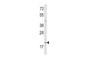 Western blot analysis of IL12A Antibody (C-term) (ABIN652744 and ABIN2842492) in MDA-M cell line lysates (35 μg/lane). (IL12A Antikörper  (C-Term))