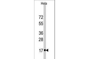 Western blot analysis of IFITM3 polyclonal antibody  in HeLa cell line lysates (35 ug/lane). (IFITM3 Antikörper  (Internal Region))