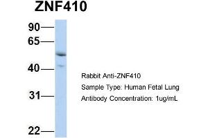 Host: Rabbit Target Name: ZNF410 Sample Type: Human Fetal Lung Antibody Dilution: 1. (ZNF410 Antikörper  (N-Term))